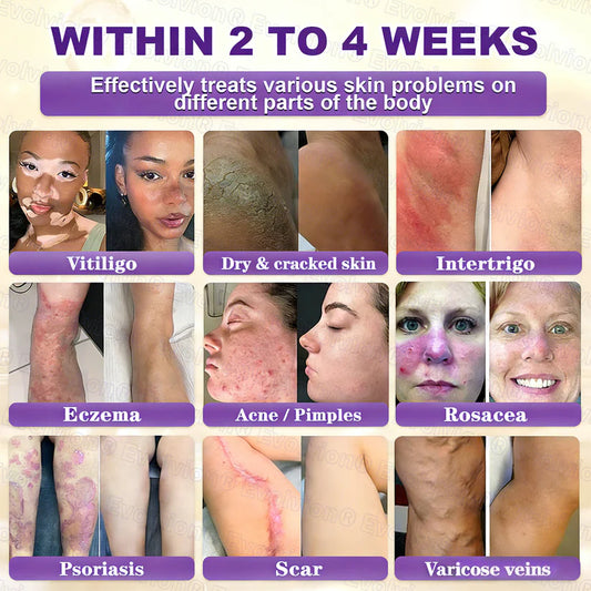 Limited-time offer: 70% off ⬇️Elivessa™ Biotin 10-in-1 Skin Restoration Cream