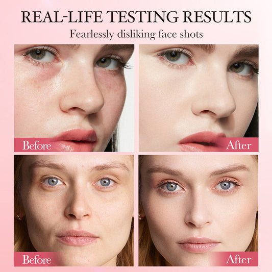 Mid-Year Sale get Free Brush- Colored Clay Undereye Corrector-You deserve to look refreshed and confident-experience the transformation today