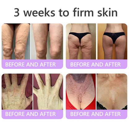 FDA Official: HISKIN PDRN Multi-Peptide Massaging Body RollerCream- Anti-aging, Hydrating, Skin Firming & Lifting, Skin Repair, Even Tone, Acne and Dark Spot Treatment, Wart and Mole Removal, and Psoriasis Relief.