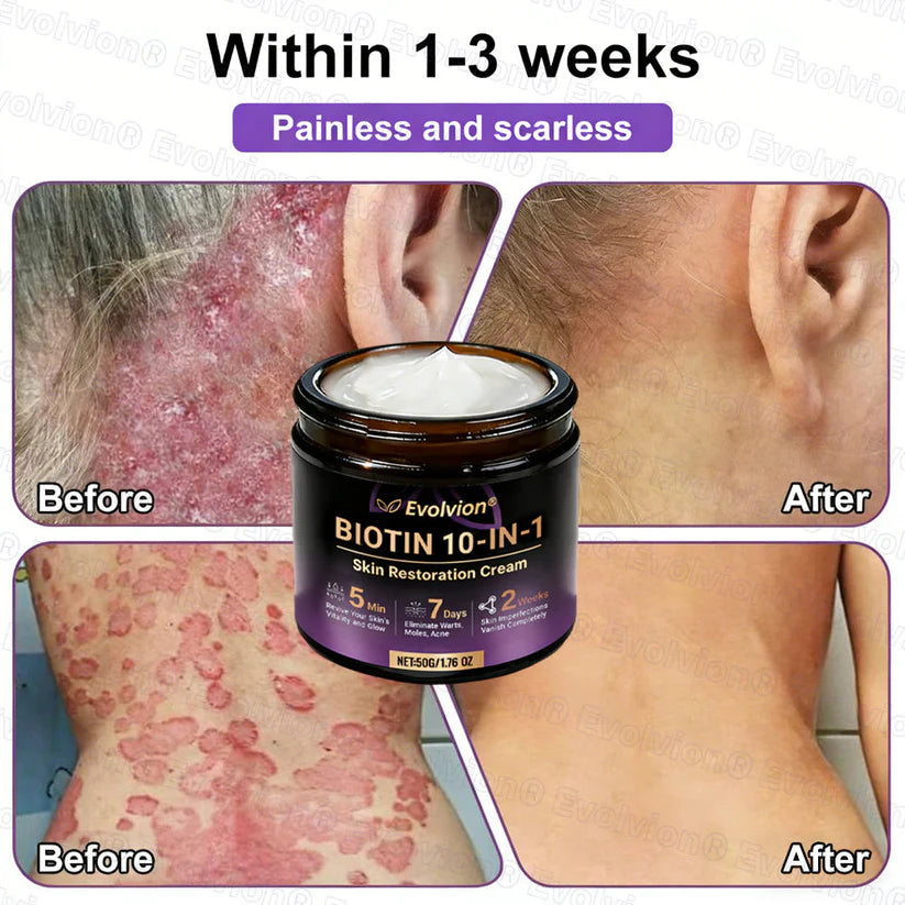 Limited-time offer: 70% off ⬇️Elivessa™ Biotin 10-in-1 Skin Restoration Cream