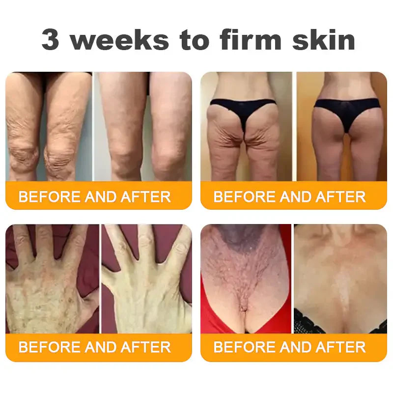 LOVILDS™ Bee Poison Skin Restoration Cream 👨‍⚕️
