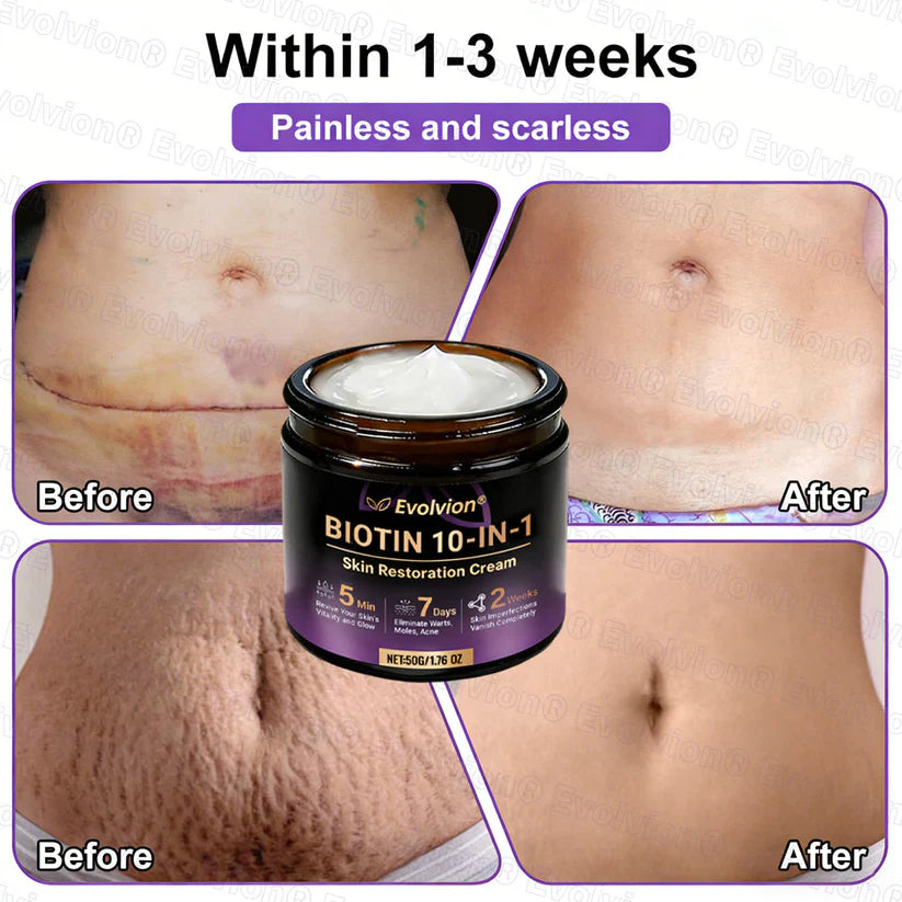 Limited-time offer: 70% off ⬇️Elivessa™ Biotin 10-in-1 Skin Restoration Cream