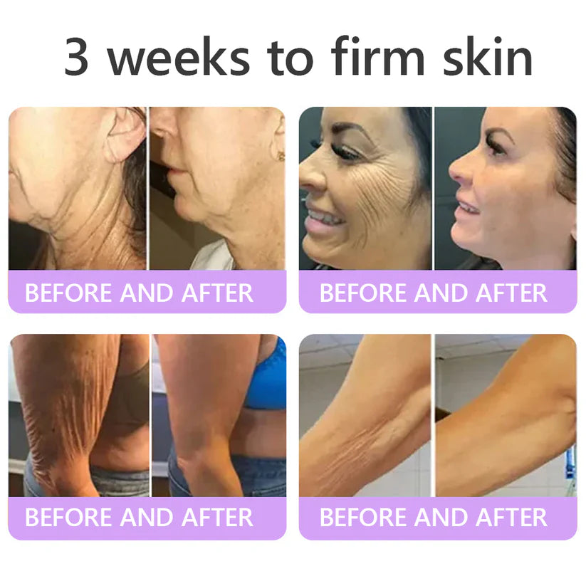 FDA Official: HISKIN PDRN Multi-Peptide Massaging Body RollerCream- Anti-aging, Hydrating, Skin Firming & Lifting, Skin Repair, Even Tone, Acne and Dark Spot Treatment, Wart and Mole Removal, and Psoriasis Relief.