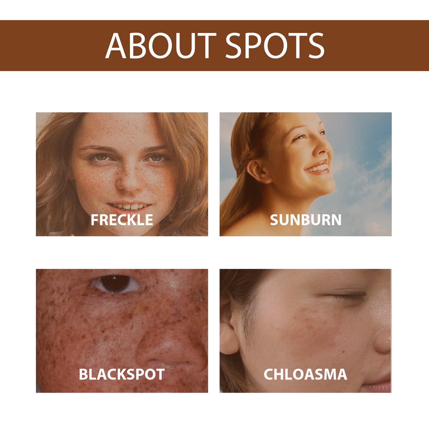 Facial serum, vitamin C brightening cream, spot-removing cream