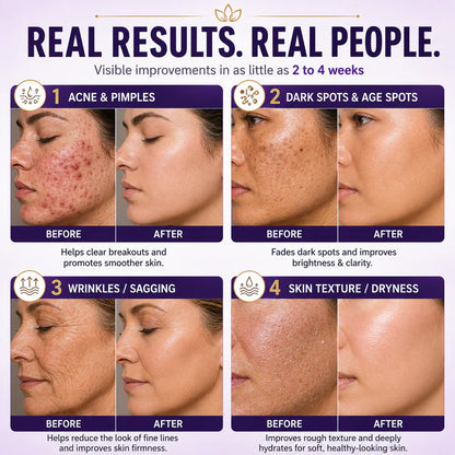 Limited-time offer: 70% off ⬇️Elivessa™ Biotin 10-in-1 Skin Restoration Cream