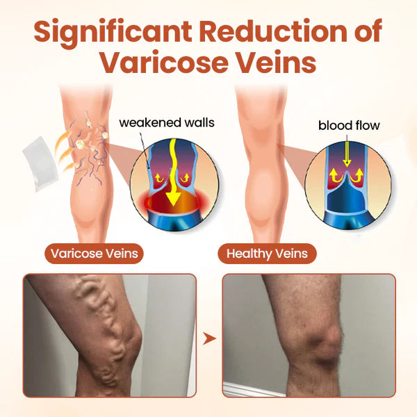 VeinTarget Microneedle Patch