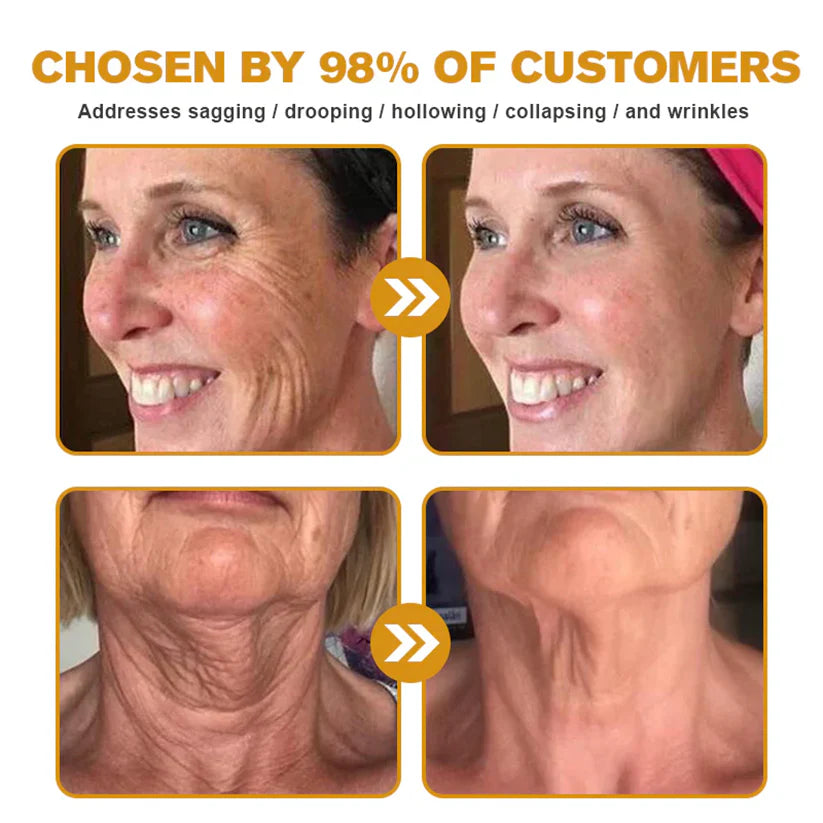 LOVILDS™ Bee Poison Skin Restoration Cream 👨‍⚕️