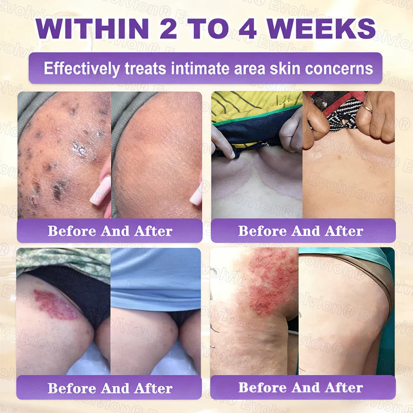 Limited-time offer: 70% off ⬇️Elivessa™ Biotin 10-in-1 Skin Restoration Cream