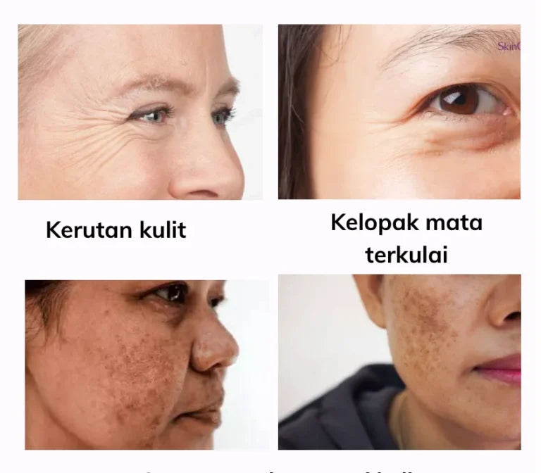 5X Pro-XylaneAnti Aging Mouizturizing Cream