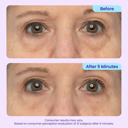 Final 3 Hours: 60%OFFInstant Lift Eye Gel forPuffiness, Bags & DarkCircles