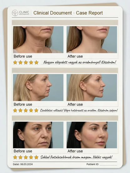 10-Year Rejuvenation Collagen Fullerene Cell Regeneration Cream🔥🔥