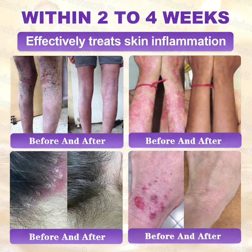 Limited-time offer: 70% off ⬇️Elivessa™ Biotin 10-in-1 Skin Restoration Cream