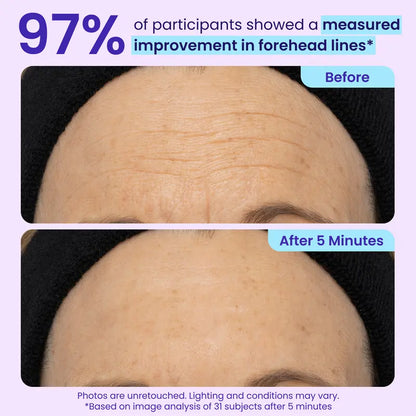 Final 3 Hours: 60%OFFInstant Lift Eye Gel forPuffiness, Bags & DarkCircles