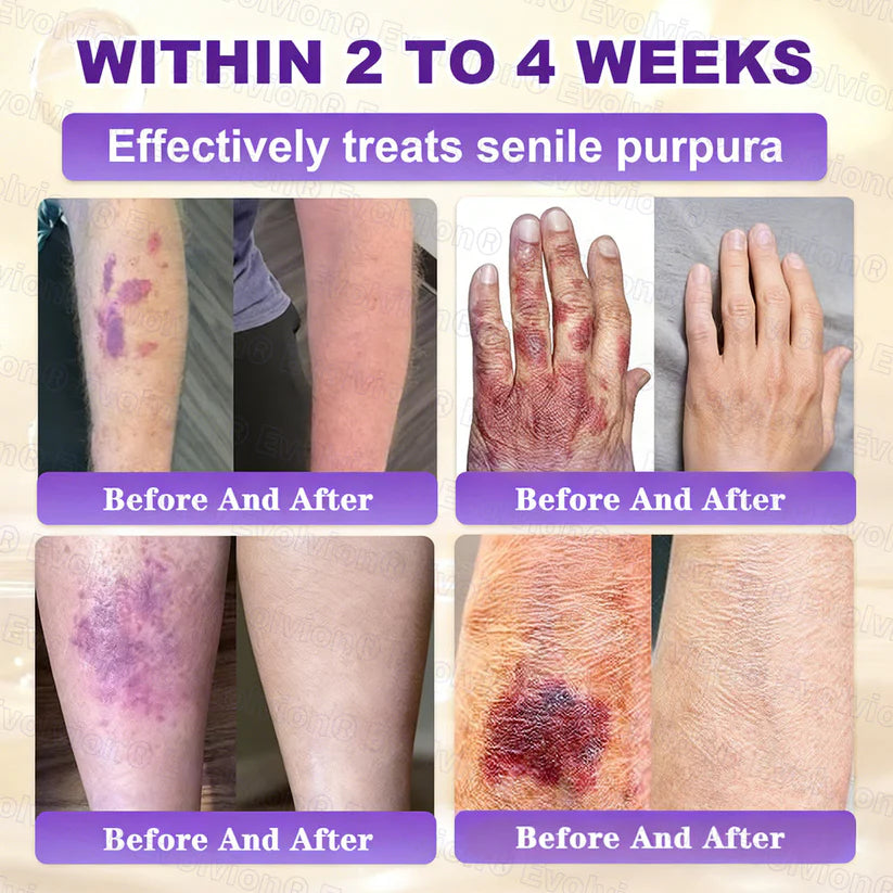 Limited-time offer: 70% off ⬇️Elivessa™ Biotin 10-in-1 Skin Restoration Cream