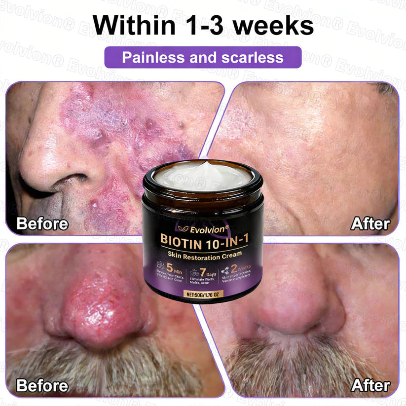 Limited-time offer: 70% off ⬇️Elivessa™ Biotin 10-in-1 Skin Restoration Cream