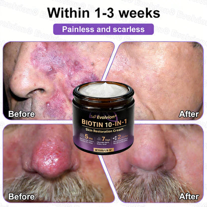 Limited-time offer: 70% off ⬇️Elivessa™ Biotin 10-in-1 Skin Restoration Cream