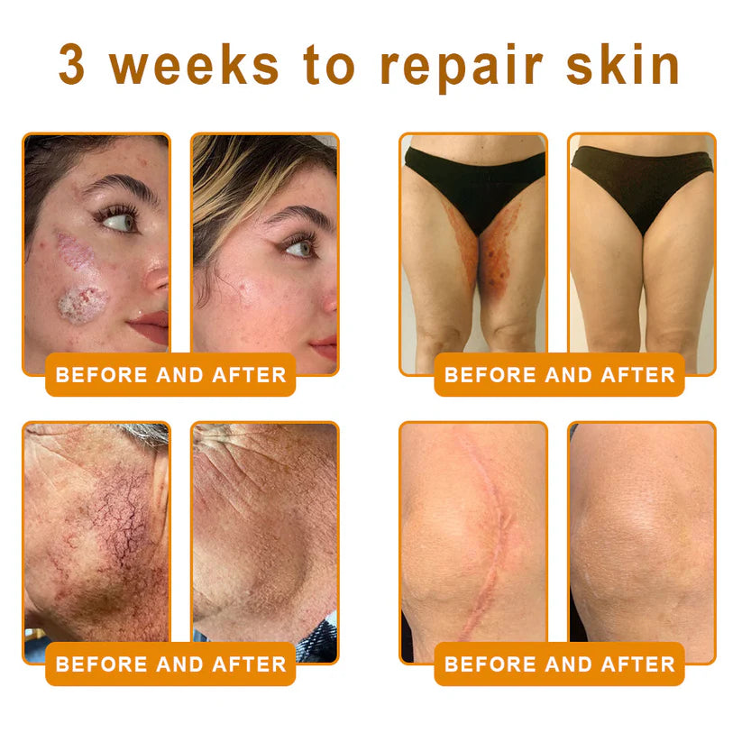 LOVILDS™ Bee Poison Skin Restoration Cream 👨‍⚕️