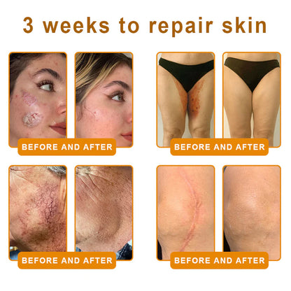 LOVILDS™ Bee Poison Skin Restoration Cream 👨‍⚕️