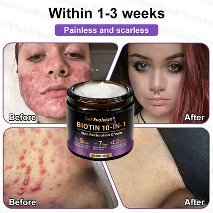Limited-time offer: 70% off ⬇️Elivessa™ Biotin 10-in-1 Skin Restoration Cream