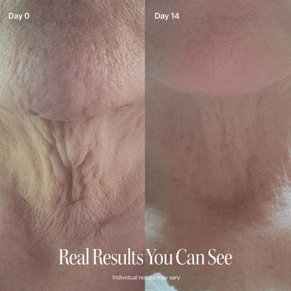PEPTIDE Face Slimming Cream